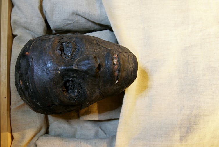 Tête de la momie de Toutankhamon, noircie par l’embaumement