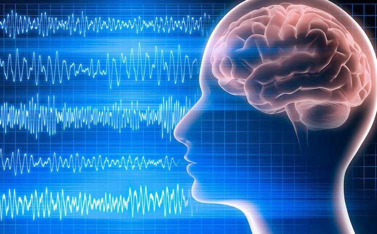Cerveau et onde électroencéphalographiques