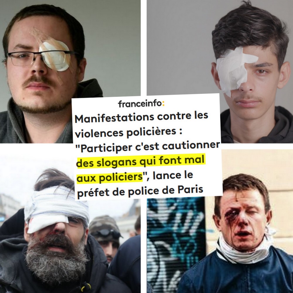 Portraits de manifestants éborgnés par la police ces dernières années