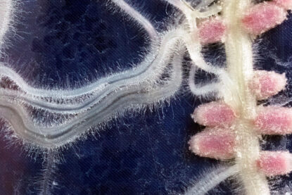 Exemple de symbiose : gros plan sur les nodules (rose) formés par des bactéries sur les racines d’une légumineuse