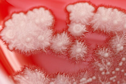 Colonies de Candida albicans (en blanc) sur un milieu nutritif gélifié et enrichi en sang dans une boîte de Petri