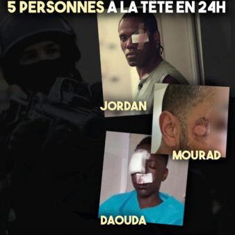 5 tirs délibérés dans la tête, 4 mutilations définitives, dont 3 mineurs. C