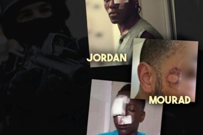 5 tirs délibérés dans la tête, 4 mutilations définitives, dont 3 mineurs. C