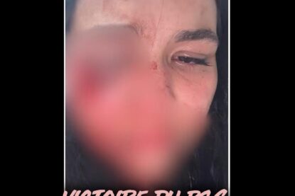 Sarah, étudiante belge mutilée pour rien à Paris, le soir de la victoire du PSG en Ligue des Champions.