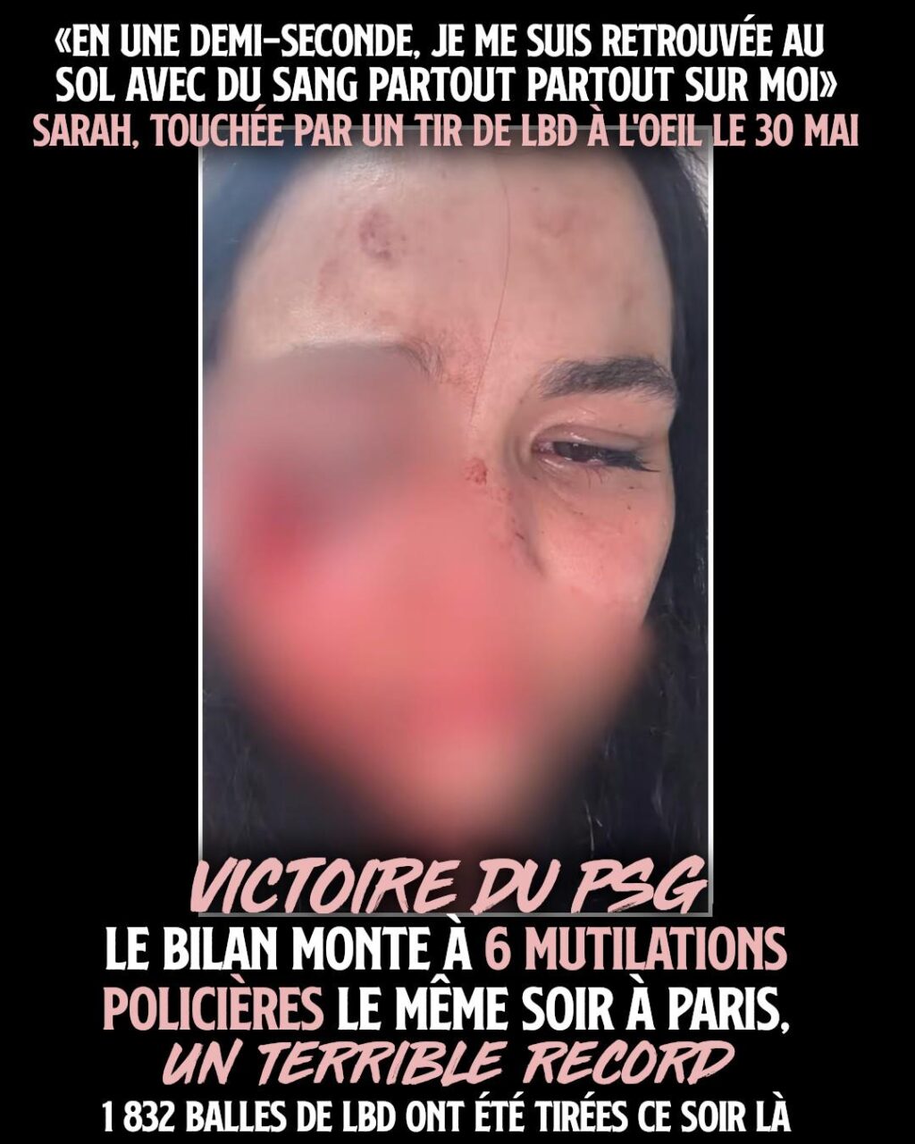 Sarah, étudiante belge mutilée pour rien à Paris, le soir de la victoire du PSG en Ligue des Champions.